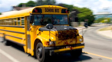 Real Life Magic School Bus Flies Through Human Body