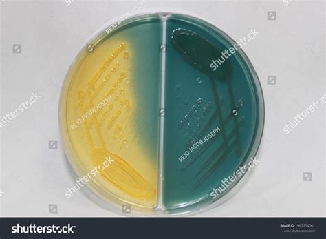 Lactose Nonlactose Fermenting Colonies On Cled Stock Photo 1967754061