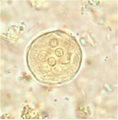 Cysts of Entamoeba coli | Medical Laboratories