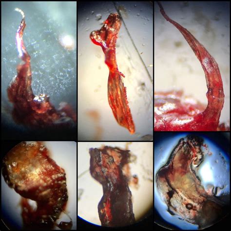 Skin Parasites Worms Demodex Face Tentacles Moxidectin At