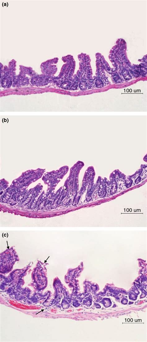 Intestinal Dysbacteriosis Contributes To Decreased Intestinal Mucosal