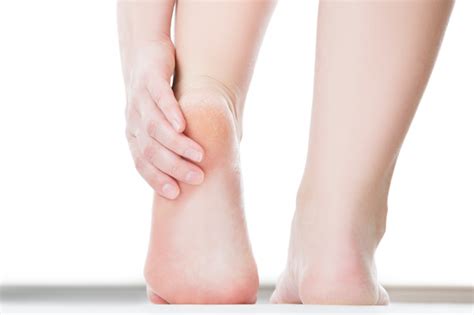 Pain in the affected bone is the most common sign of bone cancer. Are Your Calluses Actually A Sign Of Cancer? | Footfiles