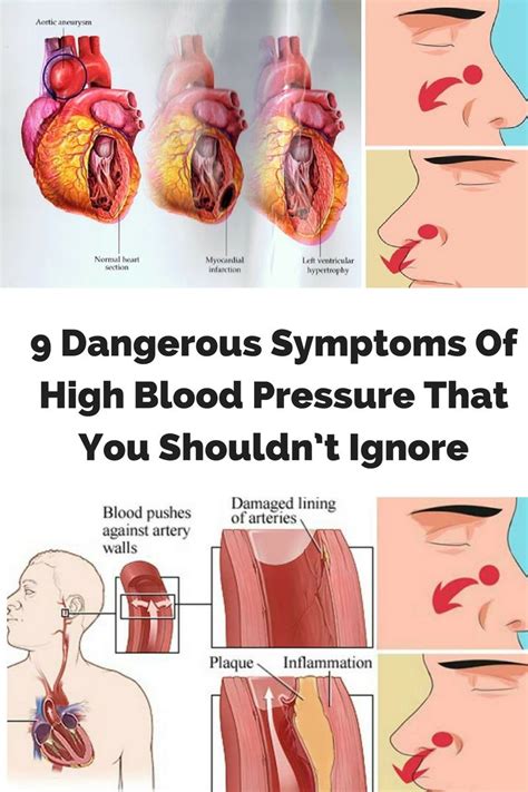 Pin On Blood Pressure