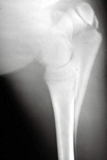 Fractures Of The Elbow In Horses Musculoskeletal System Veterinary