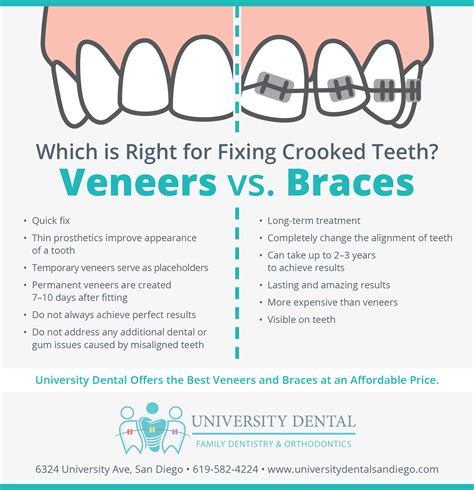 Veneers Vs Braces University Dental
