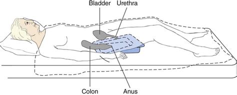 Assisting With Urinary Elimination | Nurse Key