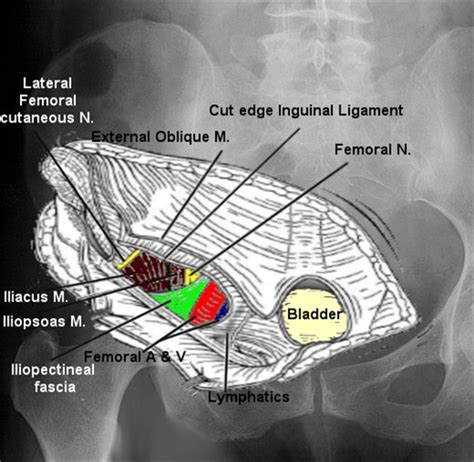 Ilioinguinal Approach To The Acetabulum Approaches Orthobullets