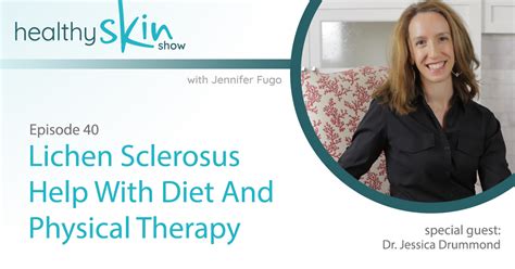 040 Lichen Sclerosus Help With Diet And Physical Therapy W Dr