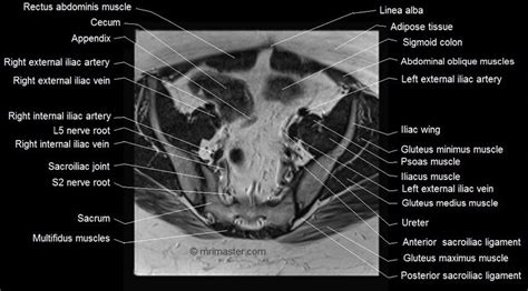 Mri Female Pelvis Anatomy Axial Image 8 Pelvis Anatomy Pelvis