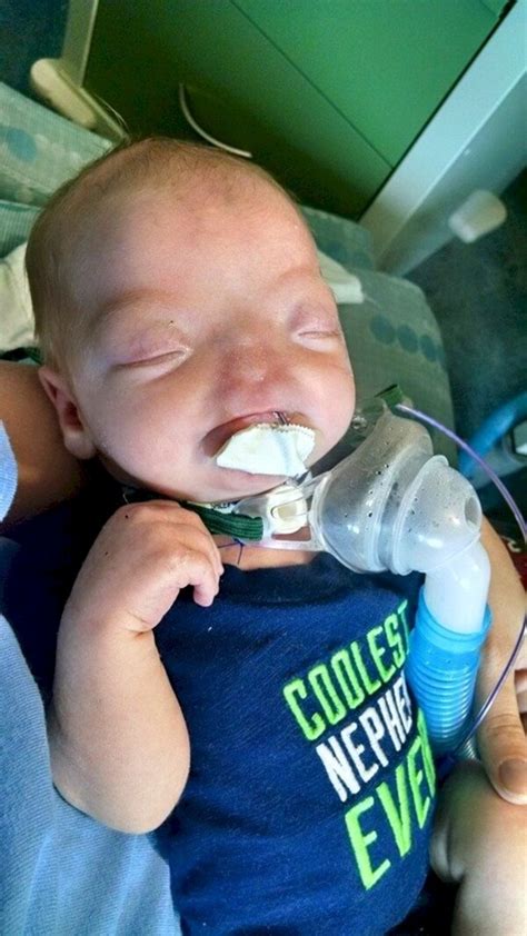 The Cutest Baby On Facebook Was Born With A Rare Condition