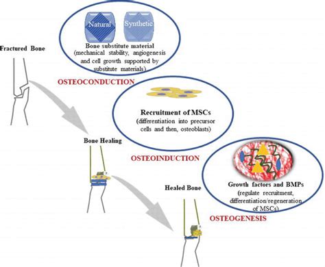 What Is The Difference Between Osteoinduction And Osteoconduction