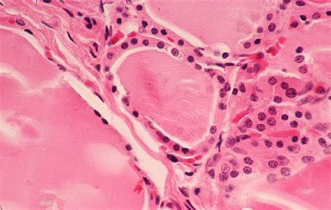 Basic Histology Cuboidal Epithelium Thyroid