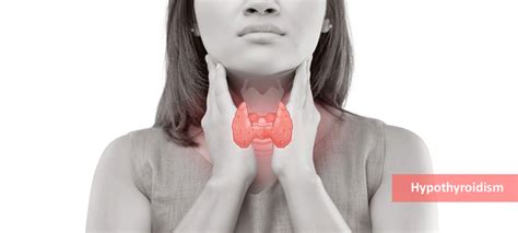 Hypothyroidism Signs Symptoms Causes Treatment Medication Health Tips