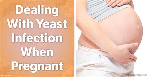 Dealing With A Yeast Infection During Pregnancy