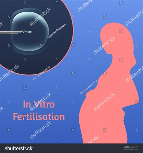 Vitro Fertilization Ivf Silhouette Pregnant Woman Stock Vector Royalty