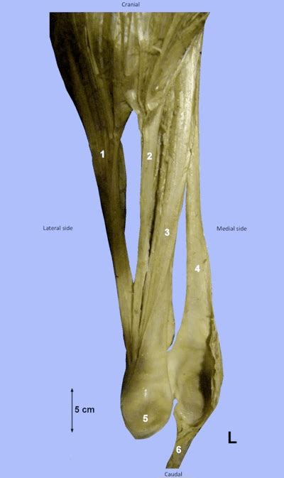 The flexor tendon system of the hand consists of the flexor muscles of the forearm, their tendinous extensions, and the specialized digital flexor sheaths. The left common calcaneal tendon in the horse. Posterior view. The... | Download Scientific Diagram