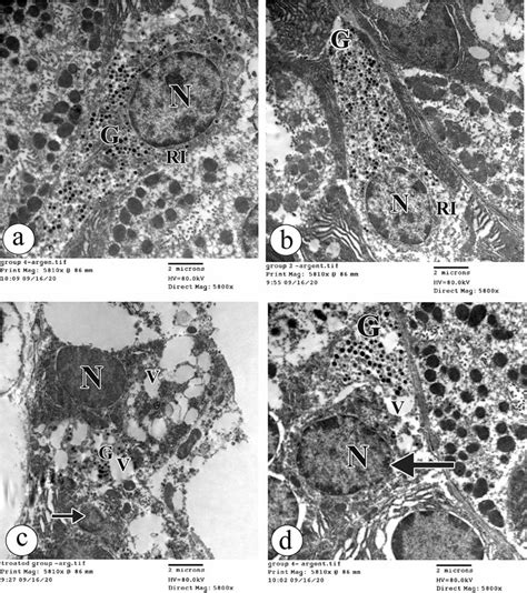 The Electron Photomicrographs Of The Enteroendocrine Cell In A