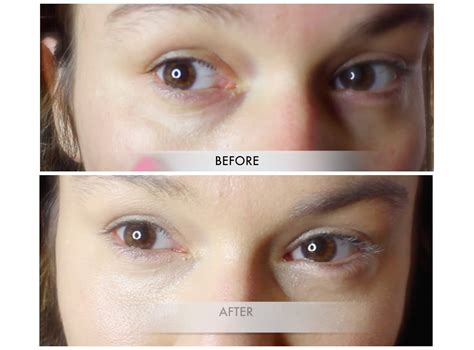 Beautiful Me Plus You How To Conceal Dark Under Eye Circles