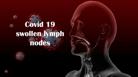 Covid 19 Swollen Lymph Nodes Latest Research Information Images And