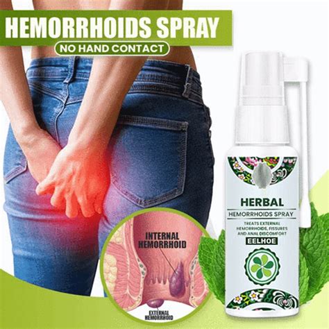 hemorrhoids ointment spray plant herbal materials powerful hemorrhoids cream internal