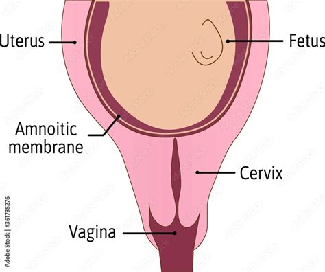 Fototapeta Cervix Is Not Effaced First Stage Of Delivery Process Cervix Is Tightly Closed And