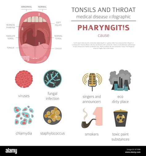 Tonsils And Throat Diseases Pharyngitis Symptoms Treatment Icon Set