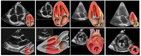 Ehokardiografija Ultrazvuk Srca Ordinacija Dr Penja Kovi