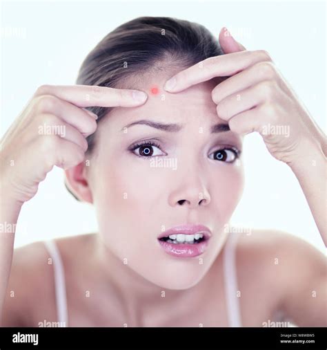 For Acne Hi Res Stock Photography And Images Alamy