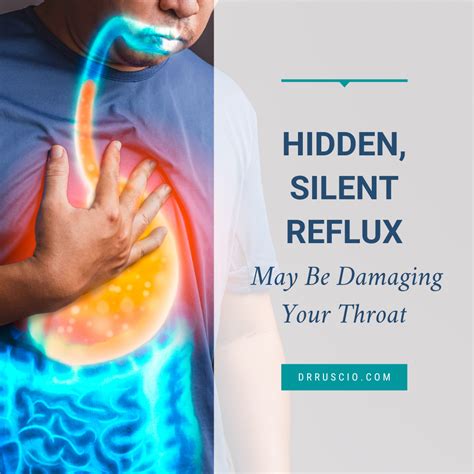 Hidden Silent Reflux May Be Damaging Your Throat