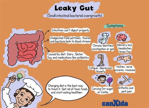 Advance Candida Antifungal Leaky Gut Syndrome Small Intestine