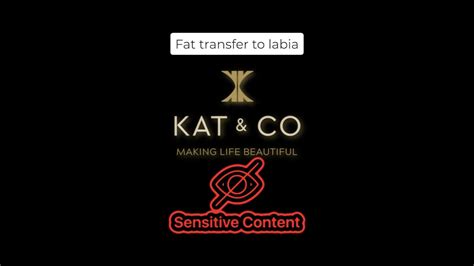 fat transfer to the labia majora youtube