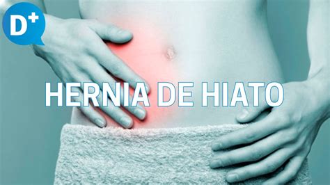 Hernia De Hiato Causas Síntomas Y Tratamiento De La Hernia De Hiato