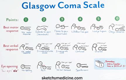 Glasgow Coma Scale Gcs Artofit
