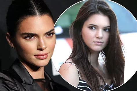 Kendall Jenners Changing Face Expert Reveals The Secrets To Her