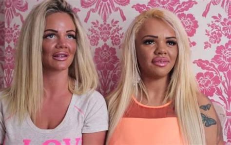 Mother And Daughter Spend 86k On Plastic Surgery To Look Like Celeb Idol Bad Plastic Surgeries
