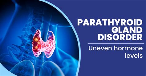 Parathyroid Gland Disorders Causes Symptoms Diagnosis And Treatment