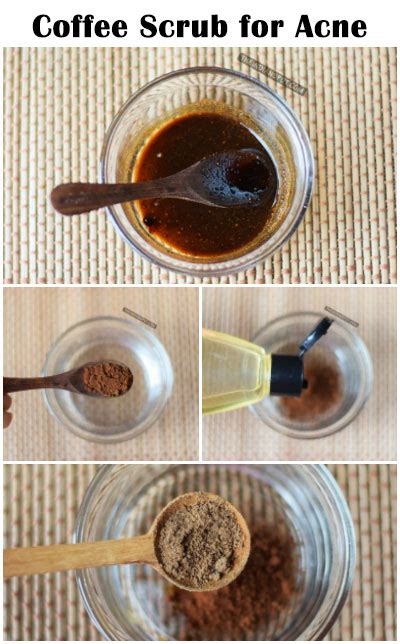 Homemade Coffee Scrub For Acne And Cellulite The Indian Spot