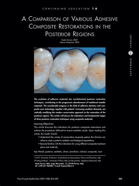 Adhesive Metal Restorations Current Concepts For The Esthetic Treatment