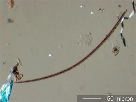 Carpet Beetle Hair Setae Under The Microscope