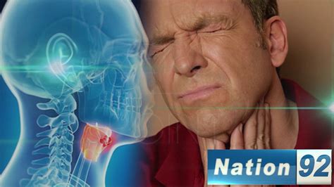 Throat Cancer Causes Symptoms And Remedies Nation92 Easy Tips To