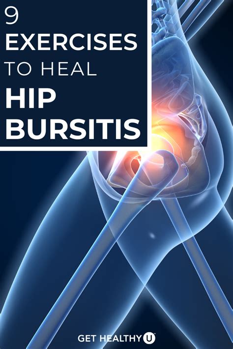9 Best Exercises For Hip Bursitis Video Included In 2021 Best