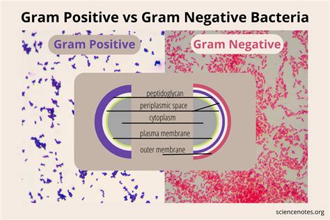 Gram Positive Vs Gram Negative Bacteria