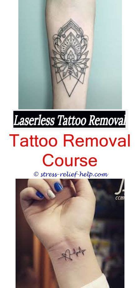 Many people assume that laser tattoo removal is guaranteed to leave some scars behind. Best numbing cream for laser tattoo removal.Best tattoo ...
