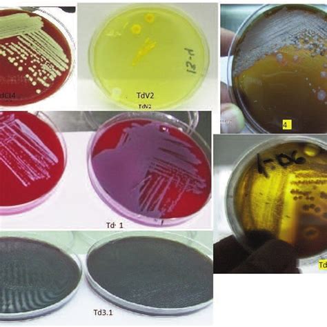 Representative Images Of Culture Plates In The Upper Left A Blood Agar