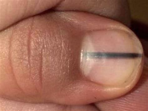 The Important Reason Why This Photo Of A Fingernail Has