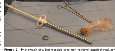 Figure 2 From Use Of A Laparoscopic Specimen Retrieval Pouch To