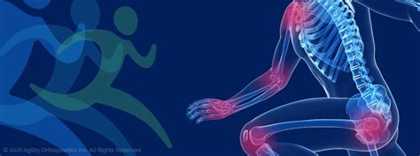 Sports Injuries Agility Orthopaedics