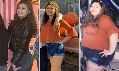 Woman 23 Who Weighed 335 Pounds Flaunts New Figure After Gastric
