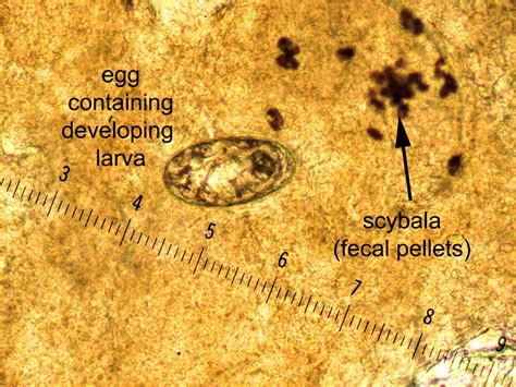 Scabies Eggs Under Microscope