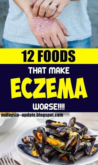 12 Foods That Make Eczema Worse Medicine Health Life